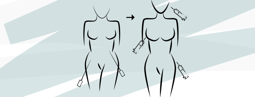 Illustration der Eigenfetttransplantation an weiblicher Brust und Hüfte.