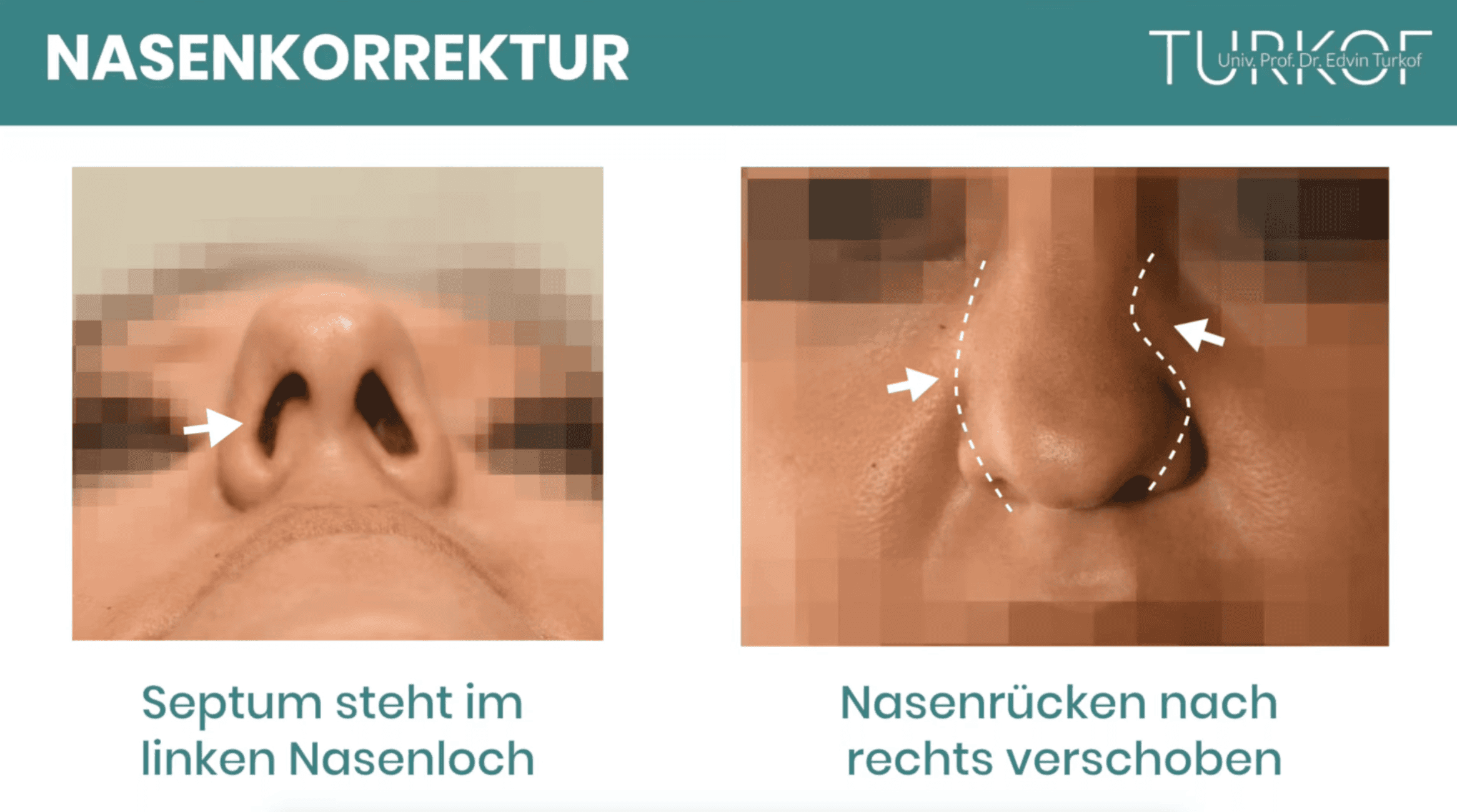 Video-Vorschaubild