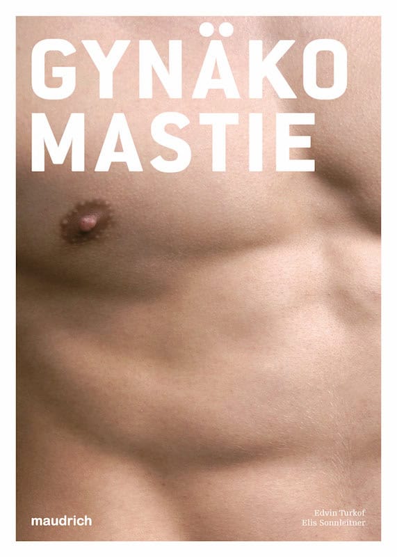 Gynäkomastie