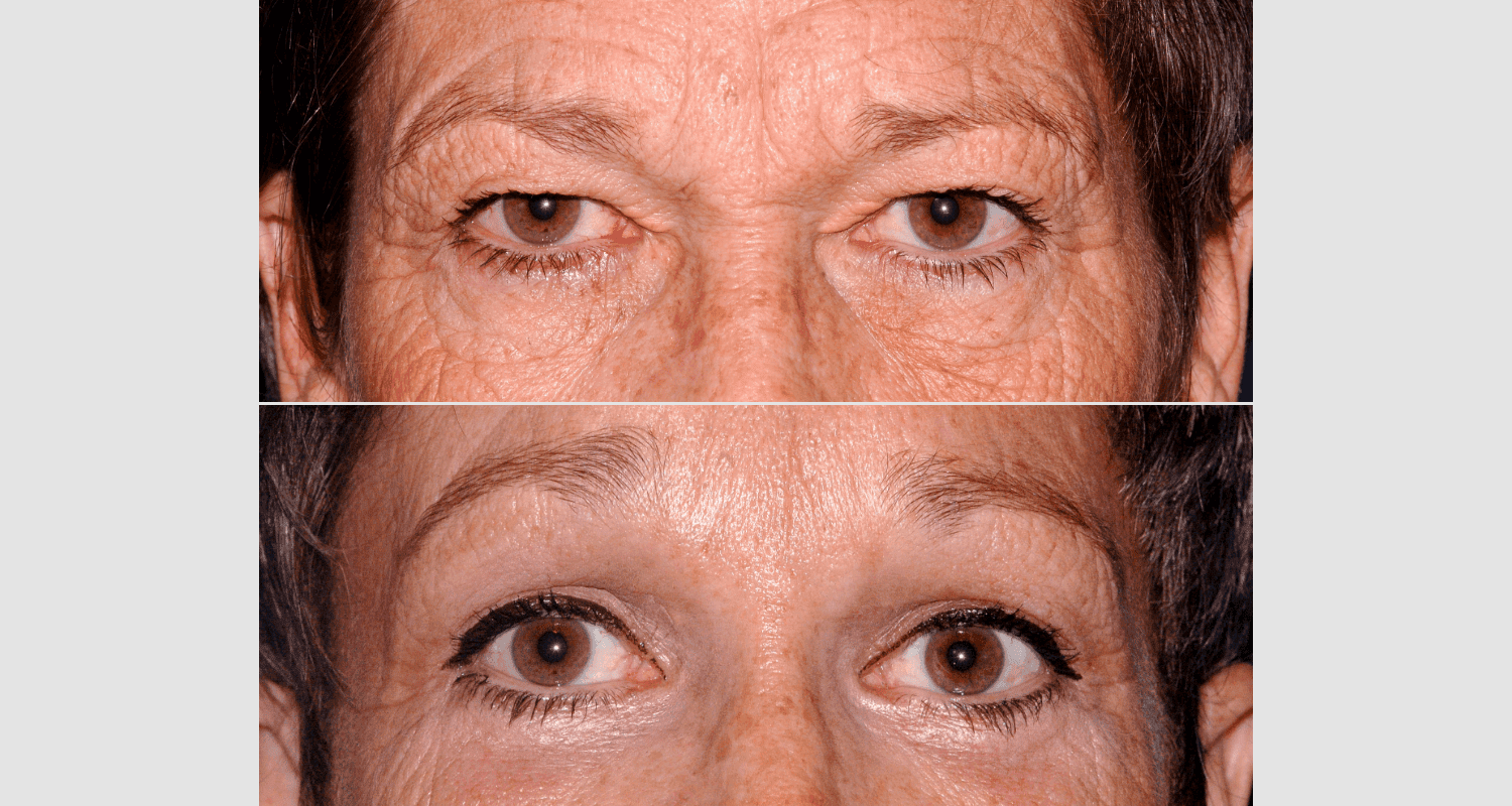Alternde Haut und Augen, Hautpflege, Anti-Aging, Gesichtspflege, natürliche Schönheit, Hautgesundheit, Gesichtsuntersuchung, Hautanalyse, Hautpflege-Tipps, Schönheitspflege
