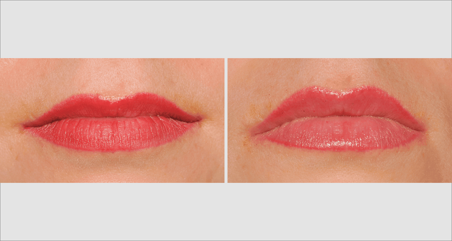 Vorher/Nachher Ergebnis: Eigenfett Lippen