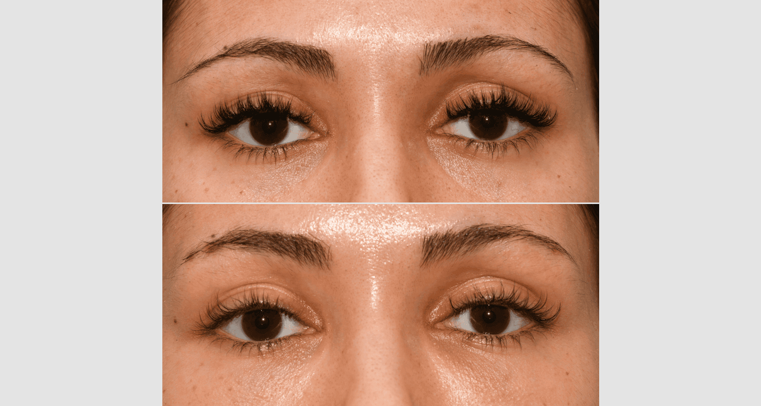 Nahaufnahme von Wimpern vor und nach der Verlängerung, detaillierte Sicht.