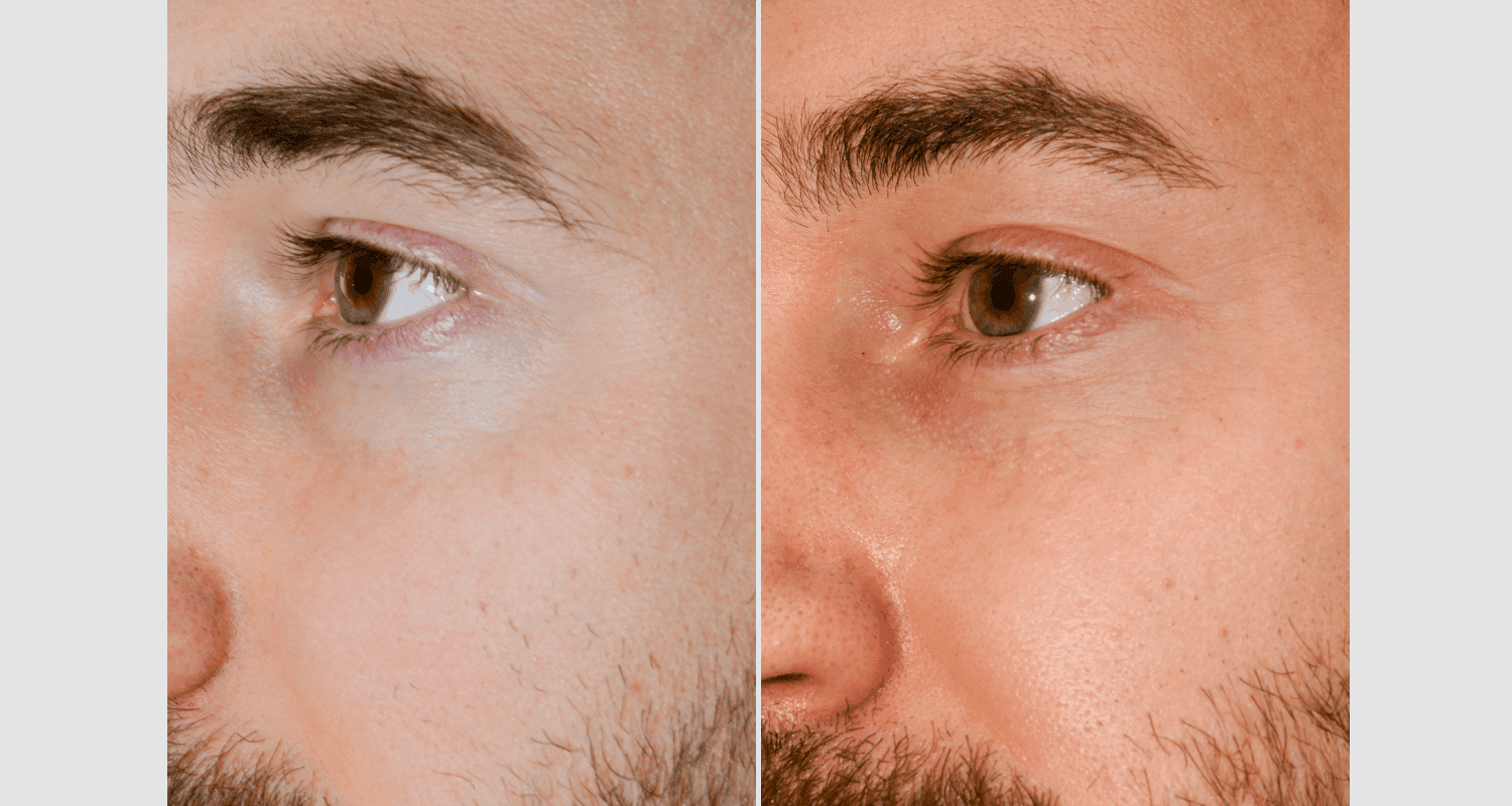 Nahaufnahme eines Mannes vor und nach der Rasur, Hautpflege, Gesichtspflege.